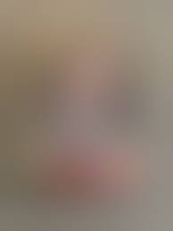 Rare Pete Rose 1987 Topps Error Card Set - Etsy