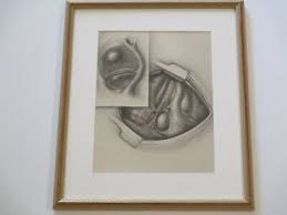 TED BLOODHART DRAWING POP ART HUMAN SCIENCE MEDICAL SURGICAL ...