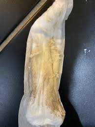 How long do I wait for sex? - Glow Community