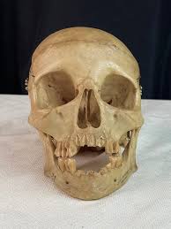 Male Human Skull