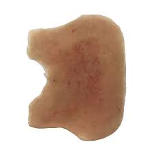 Meningitis Rash – GTSimulators.com