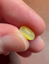 1.72 Carat Untreated Natural Opal Cat's Eye From Africa ...
