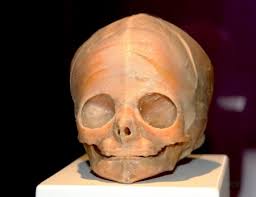 The Human Body Exhibition (14).jpg :: Lukáš Pecina