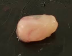 Immunotherapy - a new approach to treating bacterial ...