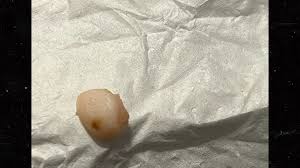 Woman Claims She Got Mouthful of Human Fingertip in ...