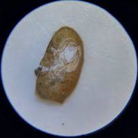 Acroloxus lacustris (Linnaeus, 1758)
