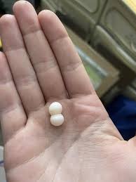 Are these eggs fertilized? : r/reptiles