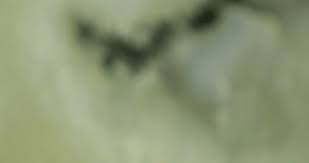 Close-up Video Circular Bcp Particles Under Stock Footage ...