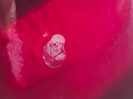 I need advice : r/fermentation