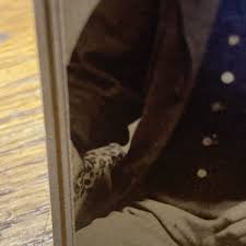 Original CDV Photo Civil War US NY Soldier Wounded Amputee ...